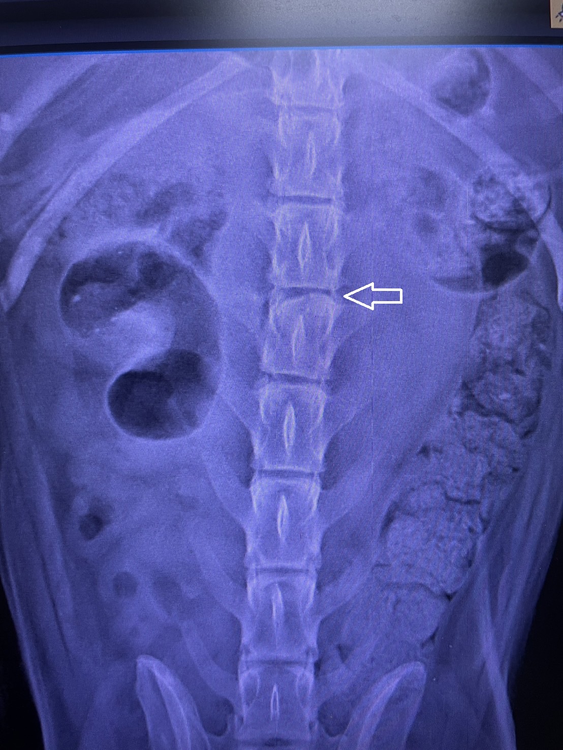 新北路邊行動不便犬 百日照護後開心奔跑 圖片集錦，共 7 張