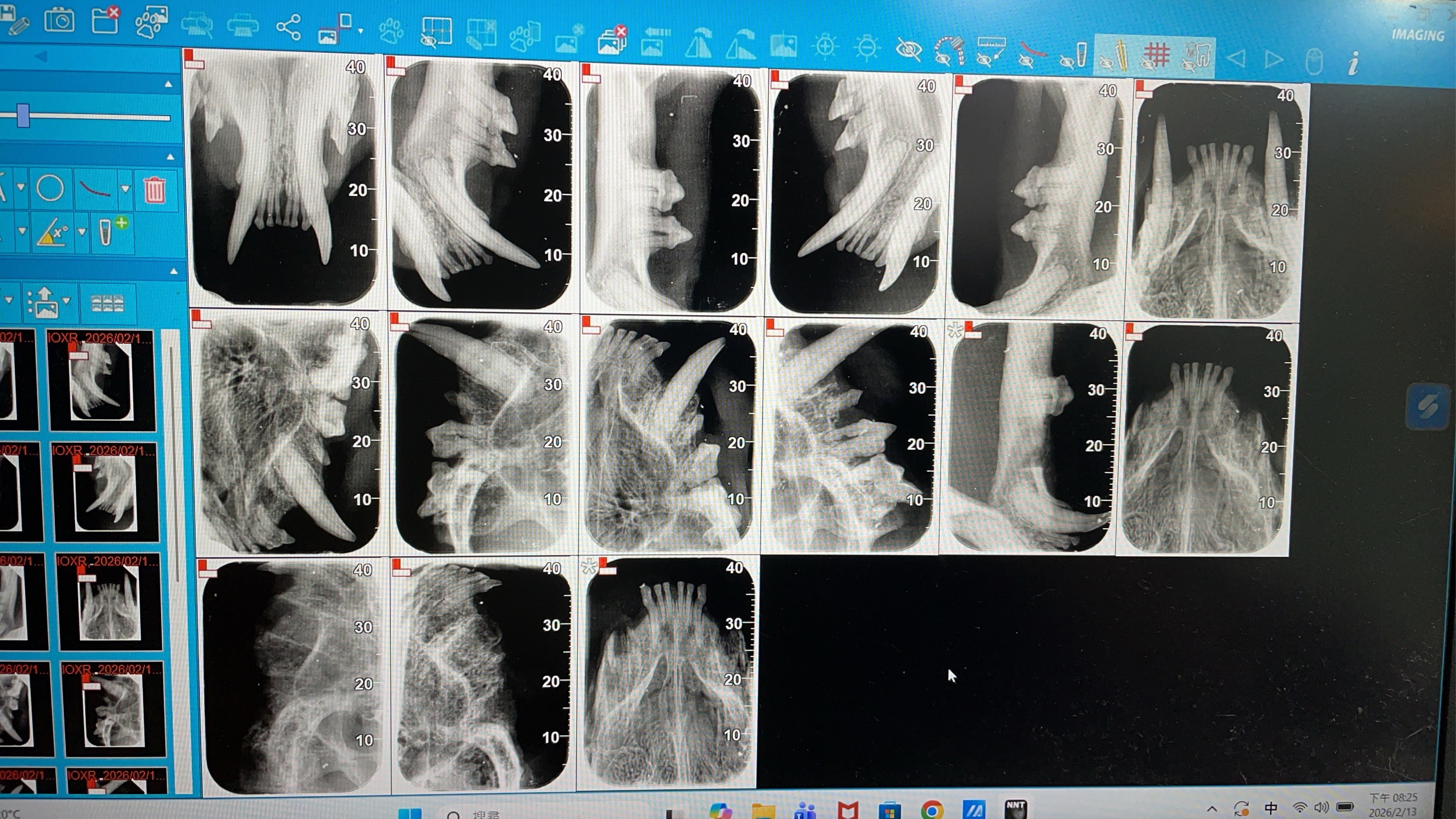 透過X光確認牙齒狀況。